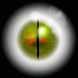 Eyes of Corporate Insight